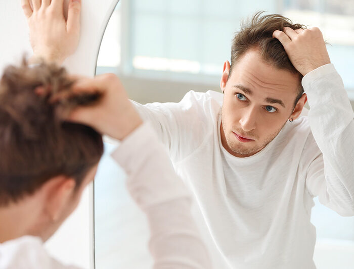 A man struggles with hair loss related to meth use.