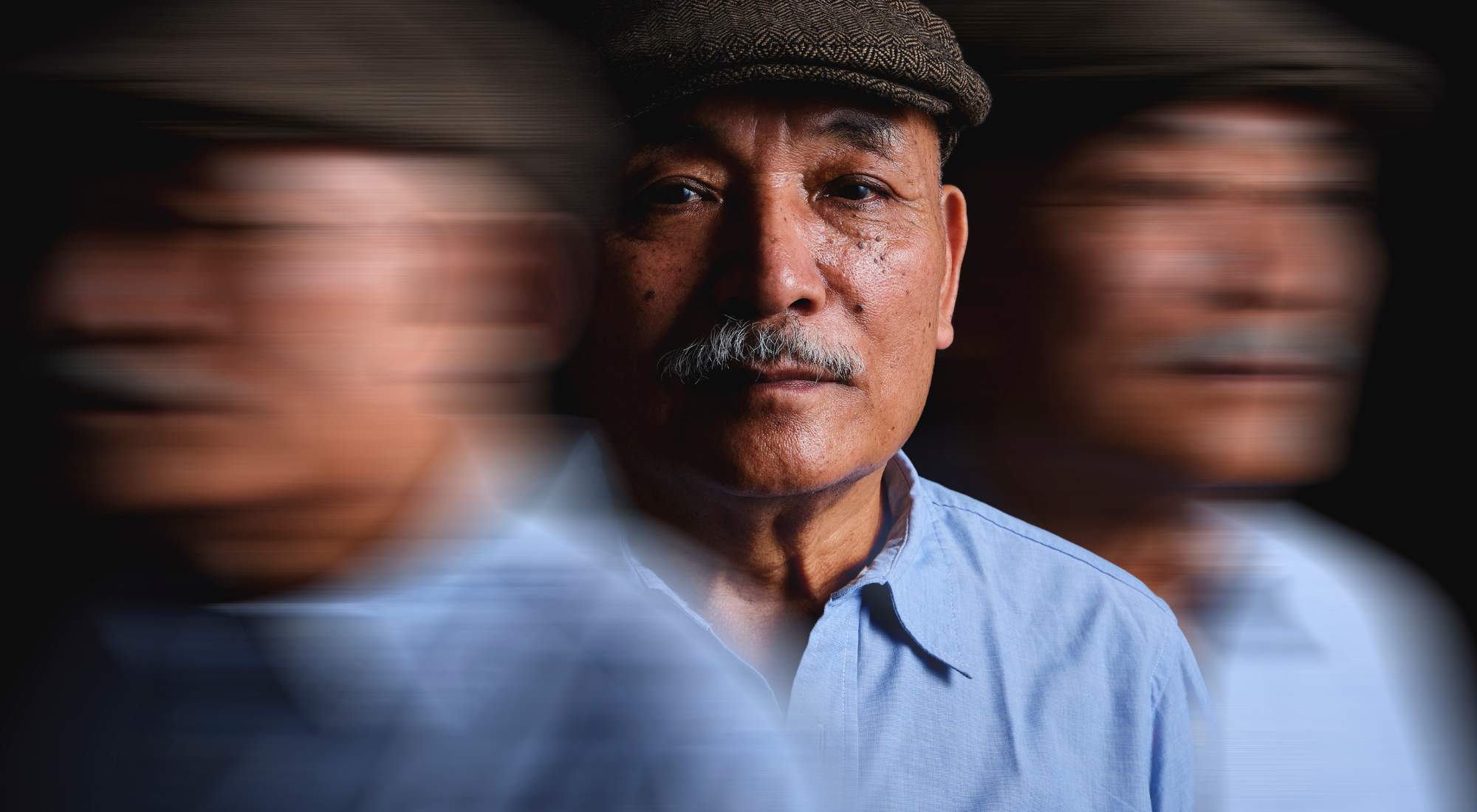 can alcoholism lead to dementia